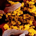 Novel coronavirus