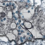 US map laid over image of COVID-19 virus